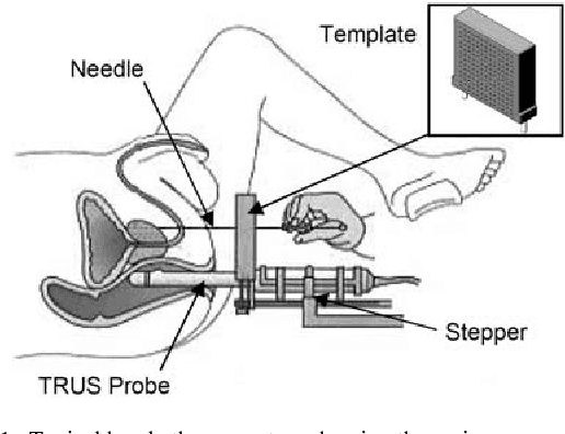 Figure 1 for Design of an ultrasound-guided robotic brachytherapy needle insertion system