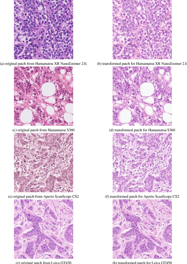 Figure 2 for Robust Multi-Domain Mitosis Detection