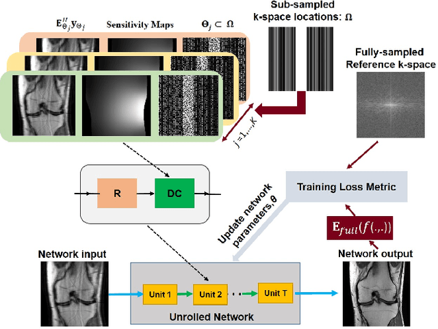 Figure 1 for Improved Supervised Training of Physics-Guided Deep Learning Image Reconstruction with Multi-Masking