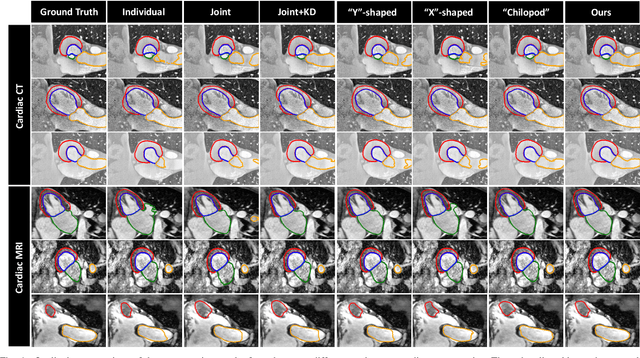 Figure 4 for Unpaired Multi-modal Segmentation via Knowledge Distillation