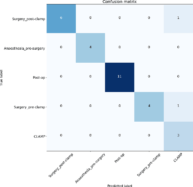 Figure 4 for Trusting Machine Learning Results from Medical Procedures in the Operating Room