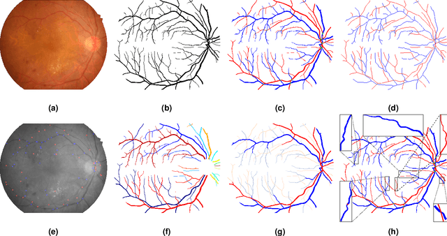 Figure 1 for The RETA Benchmark for Retinal Vascular Tree Analysis