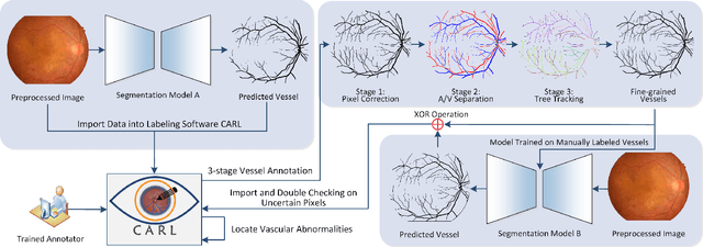 Figure 3 for The RETA Benchmark for Retinal Vascular Tree Analysis