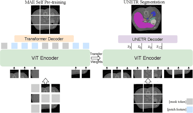 Figure 1 for Self Pre-training with Masked Autoencoders for Medical Image Analysis