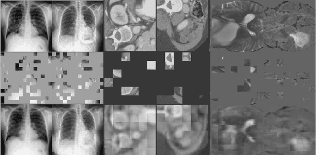 Figure 3 for Self Pre-training with Masked Autoencoders for Medical Image Analysis