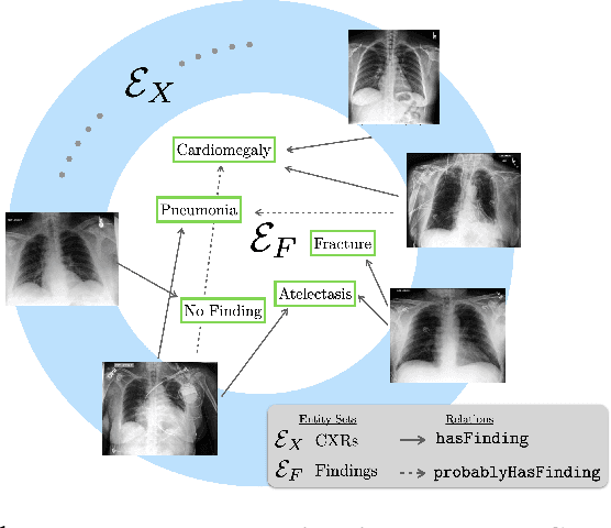 Figure 1 for A Relational-learning Perspective to Multi-label Chest X-ray Classification