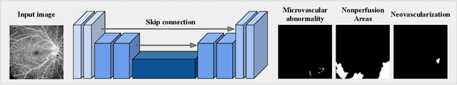 Figure 3 for Bag of Tricks for Developing Diabetic Retinopathy Analysis Framework to Overcome Data Scarcity