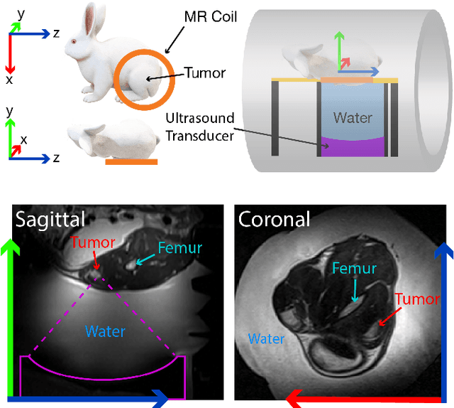 Figure 2 for Learning Multiparametric Biomarkers for Assessing MR-Guided Focused Ultrasound Treatments Using Volume-Conserving Registration