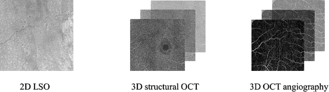 Figure 3 for Multimodal Information Fusion for Glaucoma and DR Classification