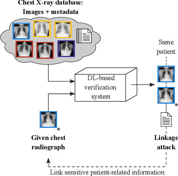 Figure 1 for Deep Learning-based Anonymization of Chest Radiographs: A Utility-preserving Measure for Patient Privacy