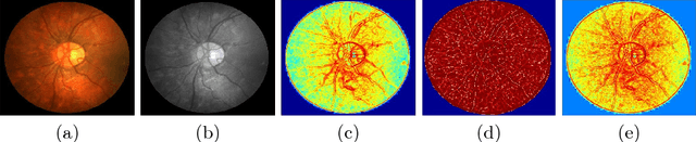 Figure 1 for Retinal Vasculature Segmentation Using Local Saliency Maps and Generative Adversarial Networks For Image Super Resolution