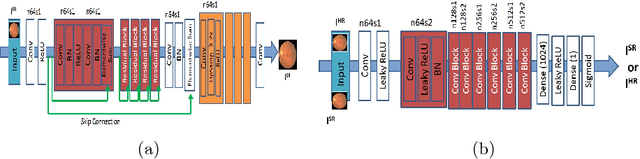 Figure 3 for Retinal Vasculature Segmentation Using Local Saliency Maps and Generative Adversarial Networks For Image Super Resolution