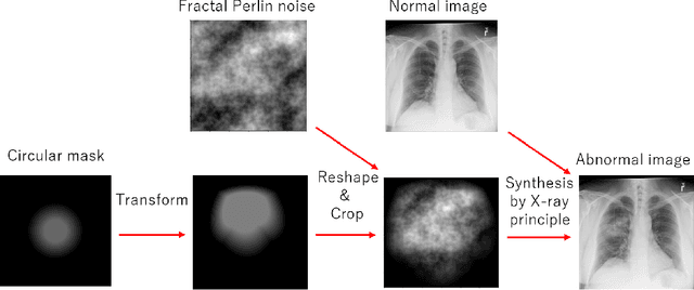 Figure 2 for Goldilocks-curriculum Domain Randomization and Fractal Perlin Noise with Application to Sim2Real Pneumonia Lesion Detection