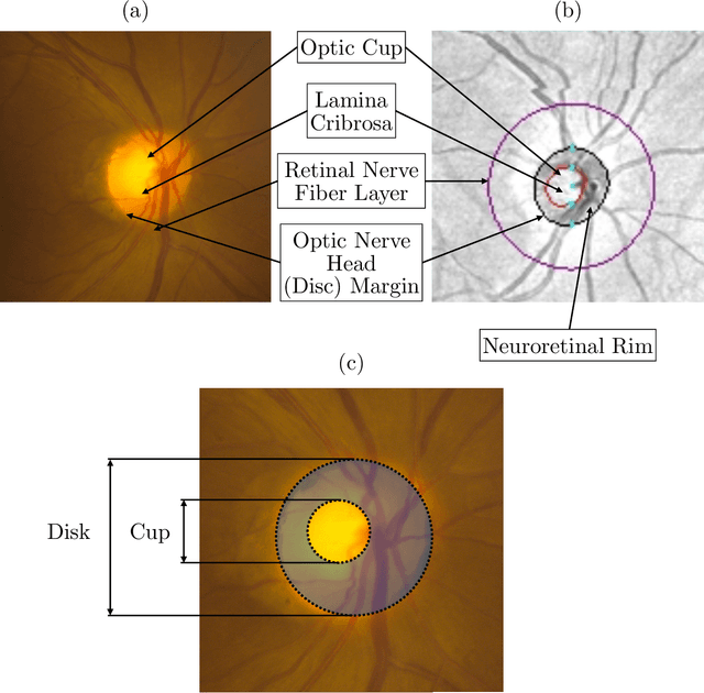 Figure 1 for Detecting Glaucoma Using 3D Convolutional Neural Network of Raw SD-OCT Optic Nerve Scans