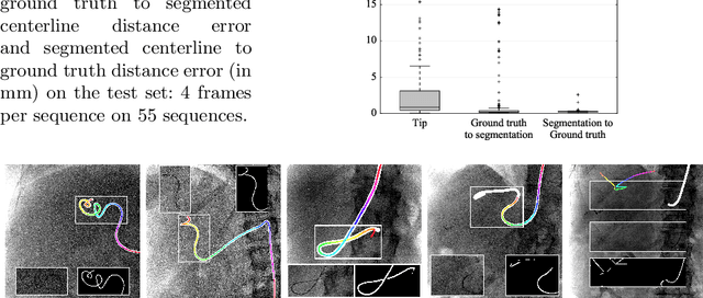 Figure 4 for Fully Automatic and Real-Time Catheter Segmentation in X-Ray Fluoroscopy