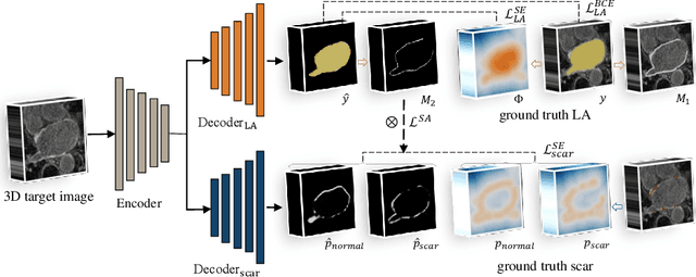 Figure 1 for Joint Left Atrial Segmentation and Scar Quantification Based on a DNN with Spatial Encoding and Shape Attention