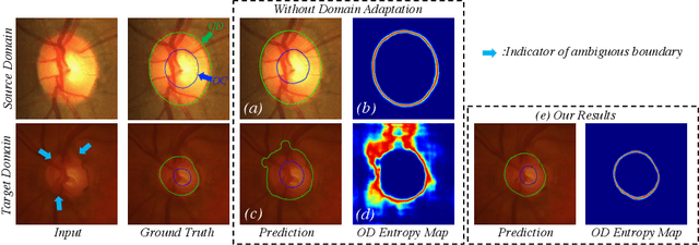 Figure 1 for Boundary and Entropy-driven Adversarial Learning for Fundus Image Segmentation