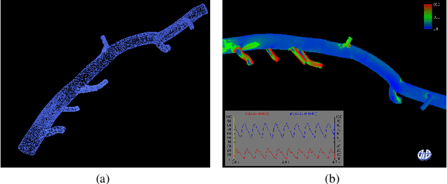 Figure 1 for Visual Exploration of Simulated and Measured Blood Flow