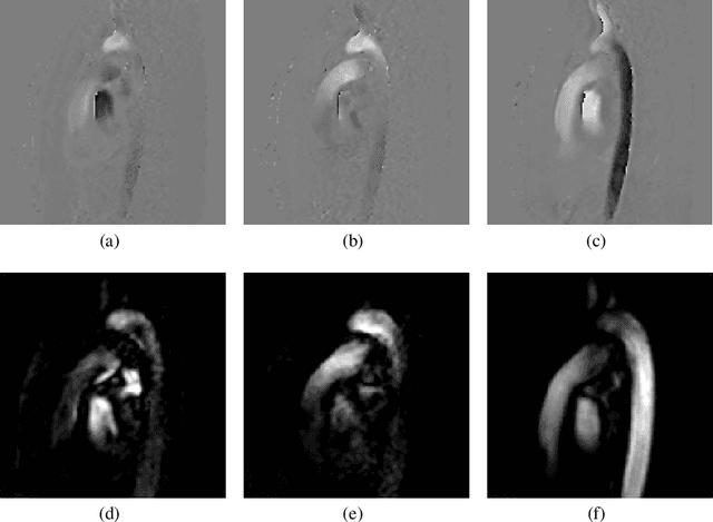 Figure 2 for Visual Exploration of Simulated and Measured Blood Flow