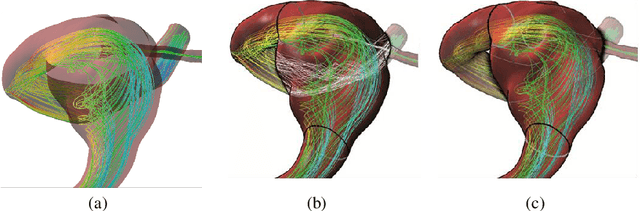 Figure 4 for Visual Exploration of Simulated and Measured Blood Flow