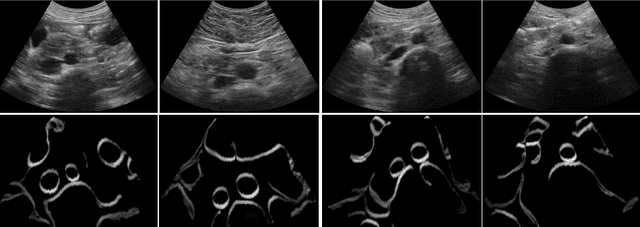 Figure 4 for CACTUSS: Common Anatomical CT-US Space for US examinations