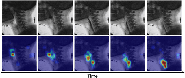 Figure 1 for Automated pharyngeal phase detection and bolus localization in videofluoroscopic swallowing study: Killing two birds with one stone?