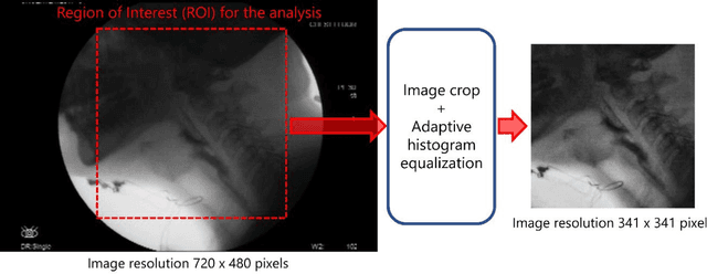 Figure 3 for Automated pharyngeal phase detection and bolus localization in videofluoroscopic swallowing study: Killing two birds with one stone?