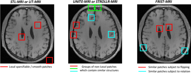 Figure 4 for Transform Learning for Magnetic Resonance Image Reconstruction: From Model-based Learning to Building Neural Networks