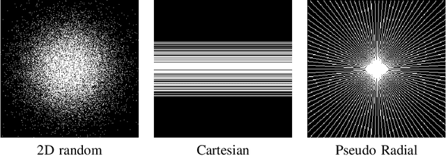 Figure 1 for Transform Learning for Magnetic Resonance Image Reconstruction: From Model-based Learning to Building Neural Networks