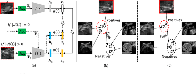 Figure 3 for Anatomy-Aware Contrastive Representation Learning for Fetal Ultrasound