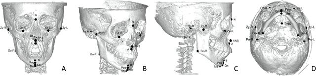 Figure 1 for Structure-Aware Long Short-Term Memory Network for 3D Cephalometric Landmark Detection