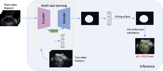 Figure 1 for FetalNet: Multi-task deep learning framework for fetal ultrasound biometric measurements