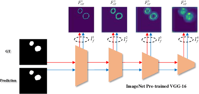 Figure 3 for Automatic Polyp Segmentation via Multi-scale Subtraction Network