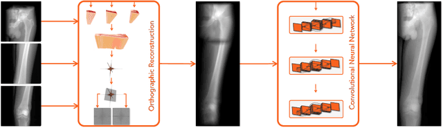 Figure 1 for From Perspective X-ray Imaging to Parallax-Robust Orthographic Stitching