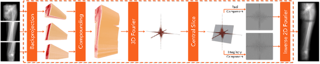 Figure 3 for From Perspective X-ray Imaging to Parallax-Robust Orthographic Stitching