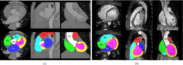 Figure 1 for Evaluation of Algorithms for Multi-Modality Whole Heart Segmentation: An Open-Access Grand Challenge