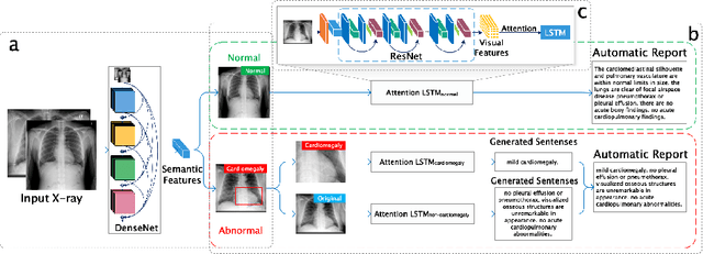 Figure 3 for Vispi: Automatic Visual Perception and Interpretation of Chest X-rays
