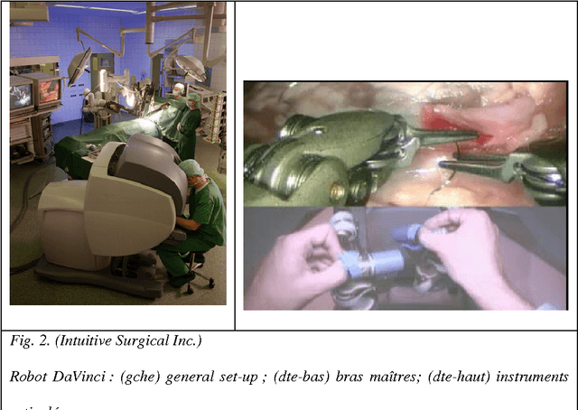 Figure 2 for Computer- and robot-assisted urological surgery