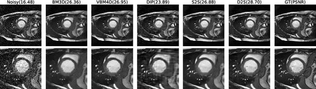 Figure 3 for Deformed2Self: Self-Supervised Denoising for Dynamic Medical Imaging