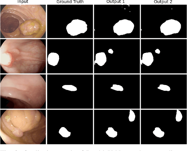 Figure 2 for DoubleU-Net: A Deep Convolutional Neural Network for Medical Image Segmentation