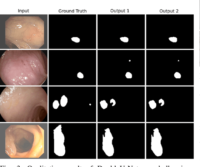 Figure 3 for DoubleU-Net: A Deep Convolutional Neural Network for Medical Image Segmentation