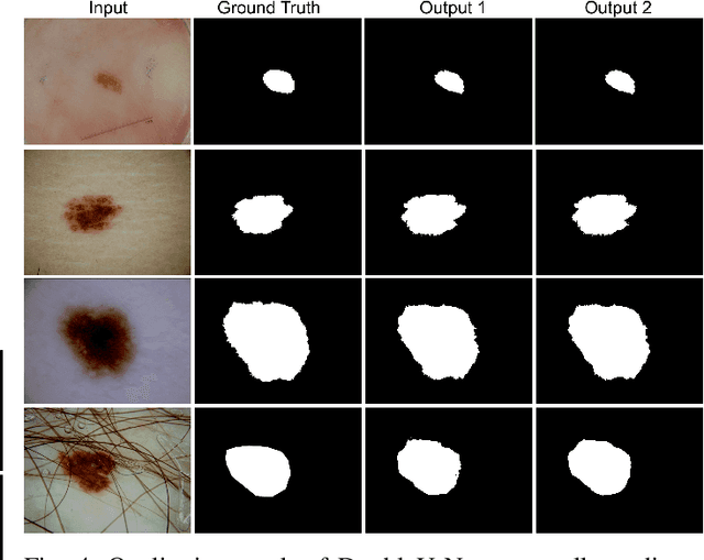 Figure 4 for DoubleU-Net: A Deep Convolutional Neural Network for Medical Image Segmentation