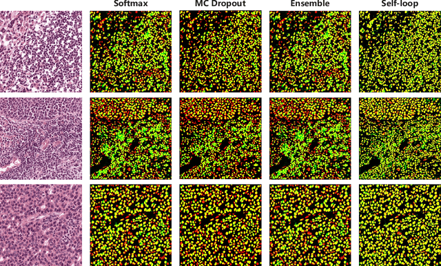 Figure 4 for Self-Loop Uncertainty: A Novel Pseudo-Label for Semi-Supervised Medical Image Segmentation