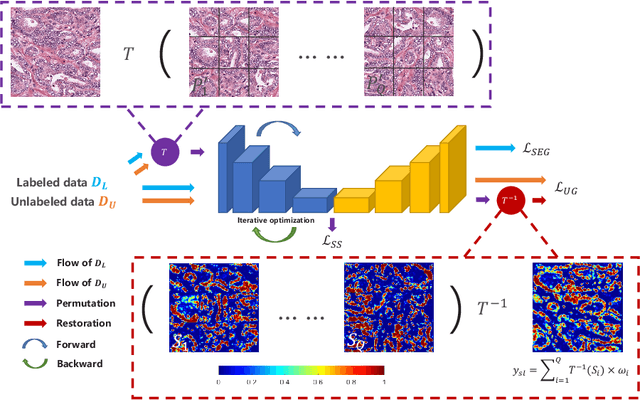 Figure 1 for Self-Loop Uncertainty: A Novel Pseudo-Label for Semi-Supervised Medical Image Segmentation