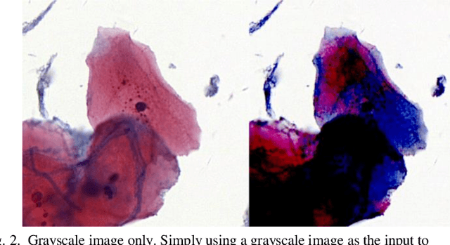 Figure 2 for Multi-stage domain adversarial style reconstruction for cytopathological image stain normalization