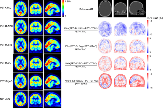 Figure 1 for Deep Learning-Based Attenuation and Scatter Correction of Brain 18F-FDG PET Images in the Image Domain