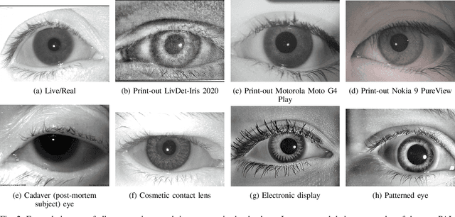 Figure 2 for Iris Liveness Detection using a Cascade of Dedicated Deep Learning Networks