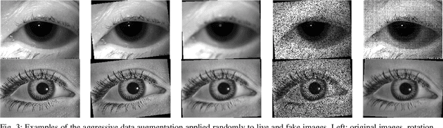 Figure 3 for Iris Liveness Detection using a Cascade of Dedicated Deep Learning Networks