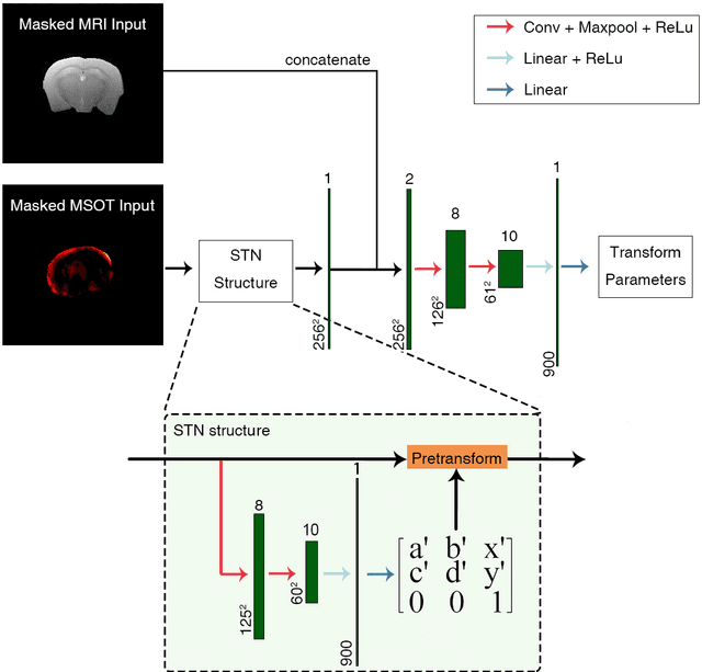 Figure 3 for Deep learning facilitates fully automated brain image registration of optoacoustic tomography and magnetic resonance imaging