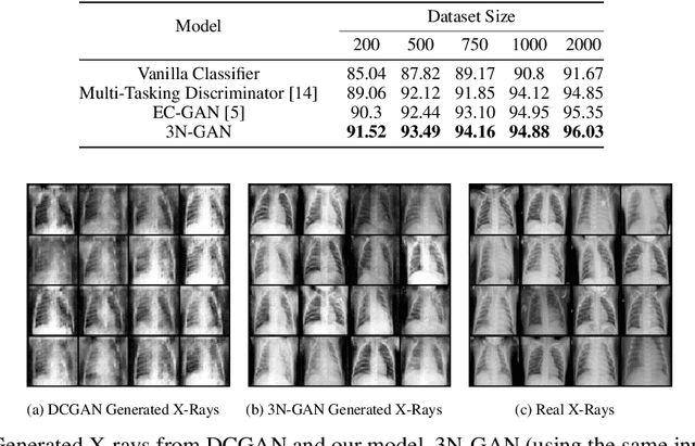 Figure 2 for 3N-GAN: Semi-Supervised Classification of X-Ray Images with a 3-Player Adversarial Framework